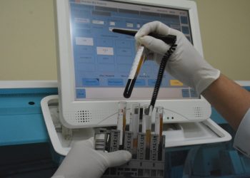 Laboratório Central recebe máquina de bioquímica de última geração