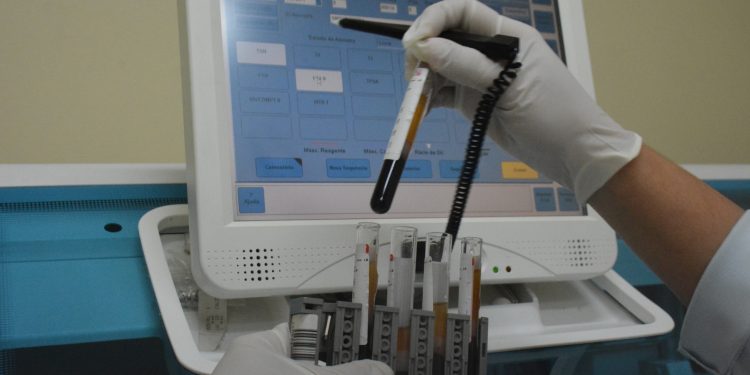 Laboratório Central recebe máquina de bioquímica de última geração