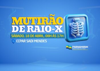 Mutirão de Raio-X é realizado neste sábado, 18 de abril.